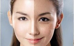 如何去除面部斑点，常见有效的方法有哪些？